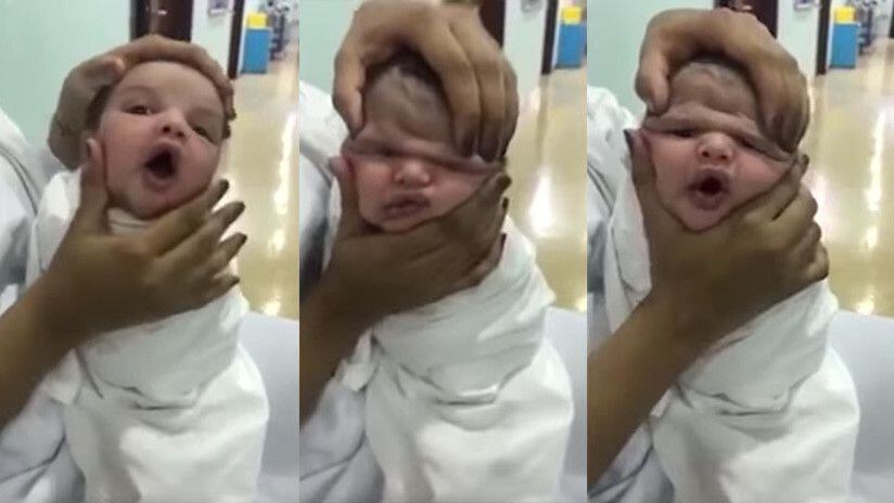 ¡INCREÍBLE! Enfermeras jugaban deformando rostros de bebés