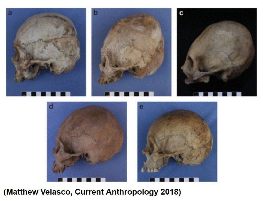 ¡NO ERAN OVNIS! Descubren el porqué de los cráneos alargados de momias peruanas 