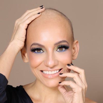 Conmueve las redes. Muere la twitera Ariana, luchó contra el cáncer hasta su último suspiro