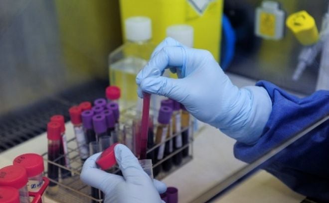 Científicos prueban una vacuna experimental contra el VIH