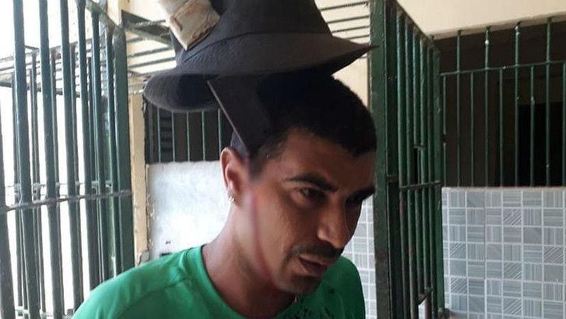Este preso brasileño tiene un machete clavado en la cabeza.Video impactante.
