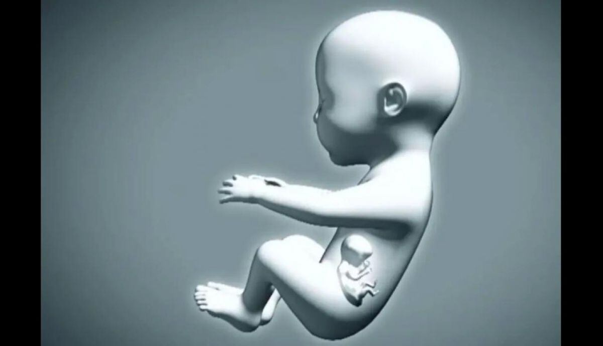 Colombia se conmociona con bebé que nace embarazada