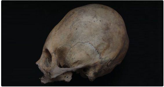 ¡NO ERAN OVNIS! Descubren el porqué de los cráneos alargados de momias peruanas 