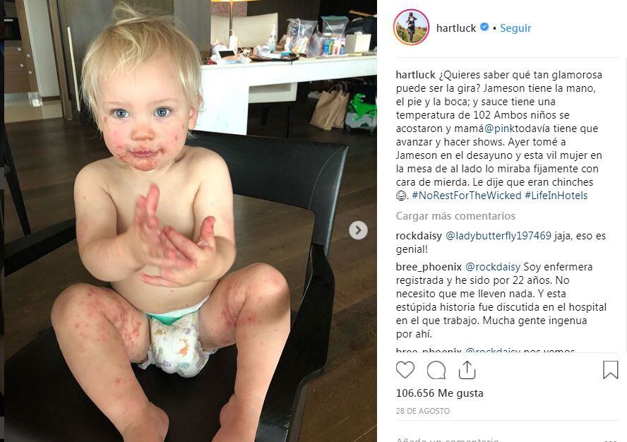 El hijo de la cantante Pink fue diagnosticado con un virus altamente contagioso