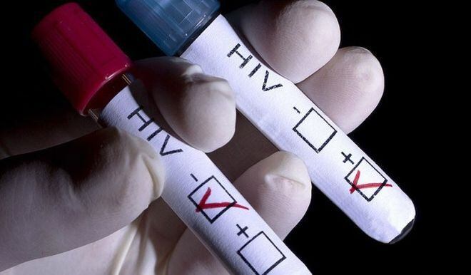 El estudio francés que podría acabar con el VIH