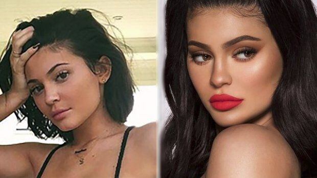 Kylie Jenner se ha dejado de inyectar volumen en los labios