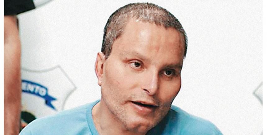 El narco desfigurado ‘Chupeta’ testifica contra el Chapo Guzmán