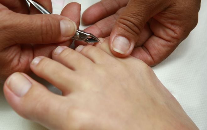 Ojo: Objetos de manicura o pedicura elevan riesgo de contraer hepatitis C
