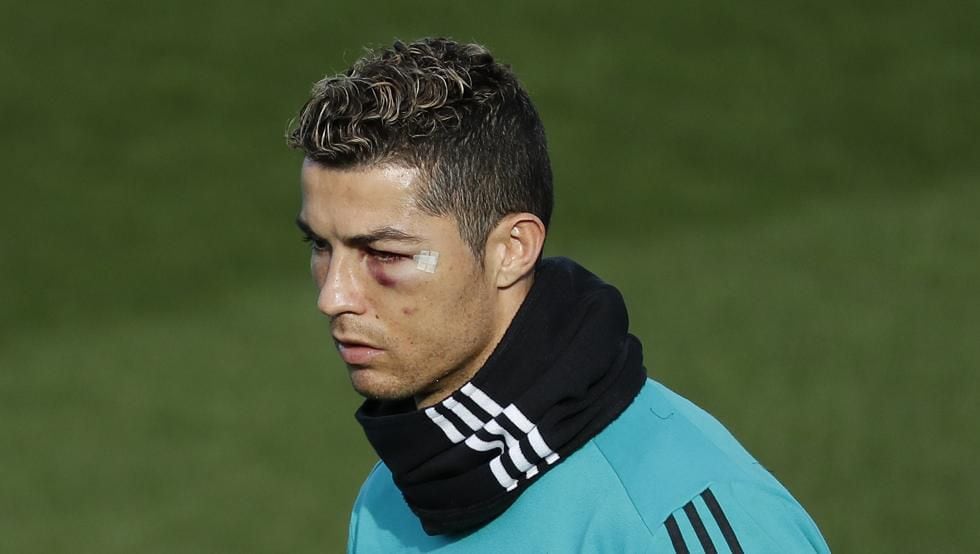 Cristiano Ronaldo apareció hinchado tras el corte que sufrió en juego